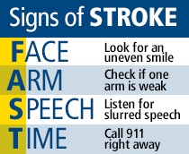 Signs of Stroke